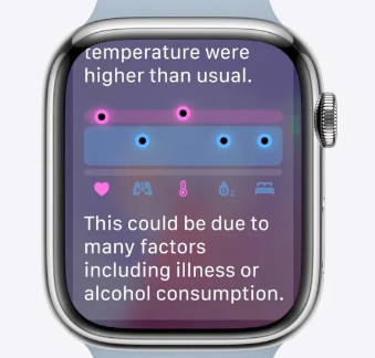 watchOS 11 公测版 1 现已推出 包含我每天使用的这 4 个功能